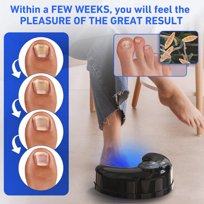 Wireless Nail Fungus Laser