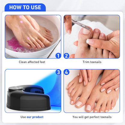 Wireless Nail Fungus Laser
