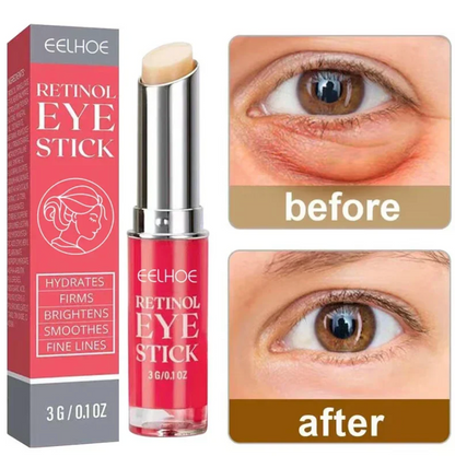 Retinol Eye Cream
